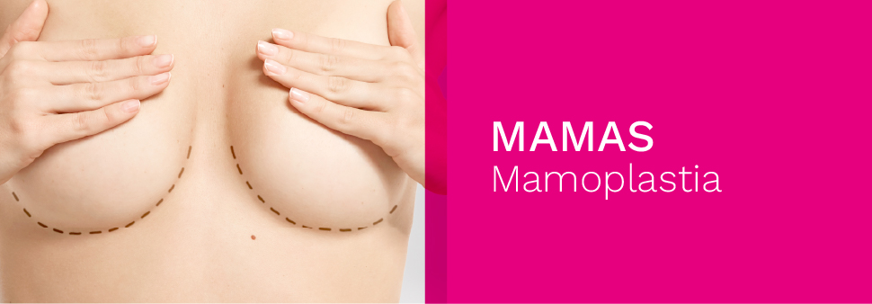MAMOPLASTIA